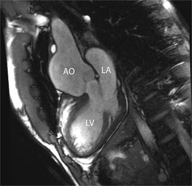 Figure 14.