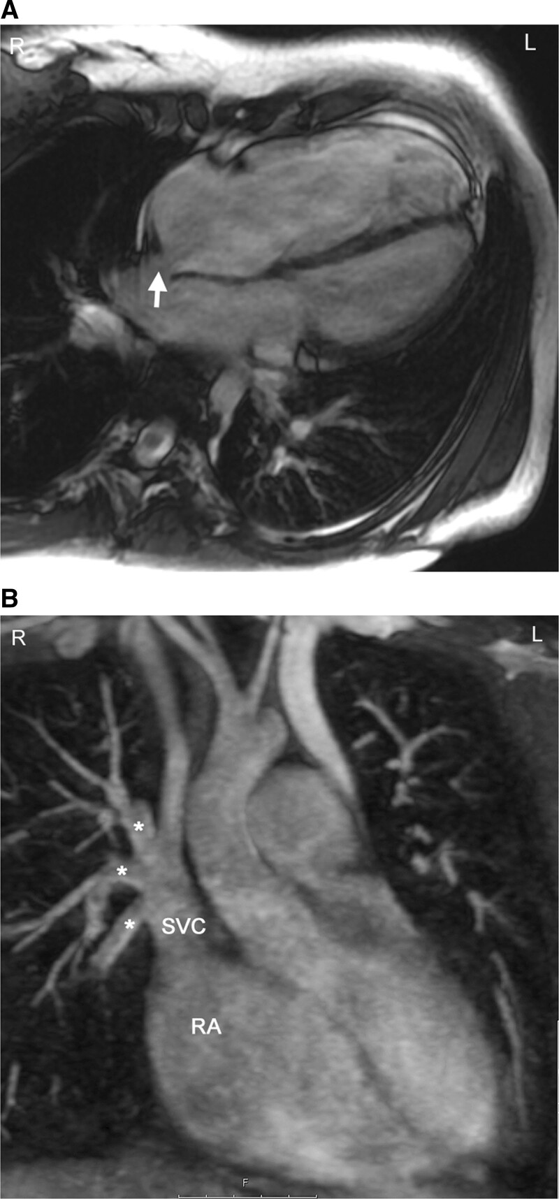 Figure 15.