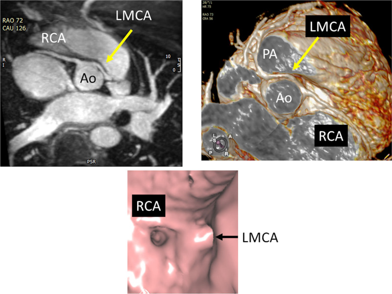 Figure 22.