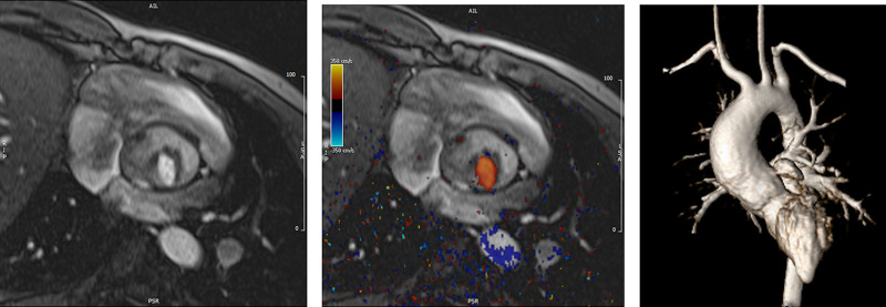 Figure 31.