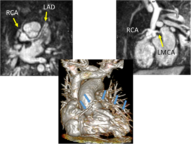 Figure 20.