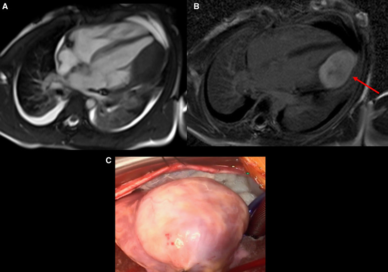 Figure 45.