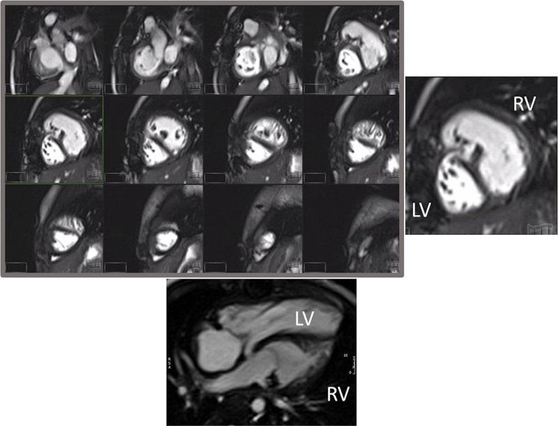 Figure 41.