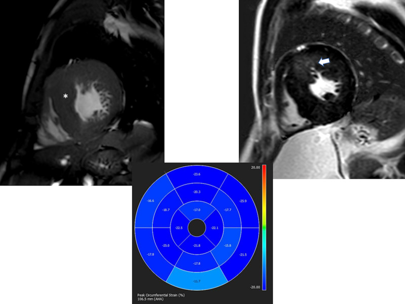 Figure 43.