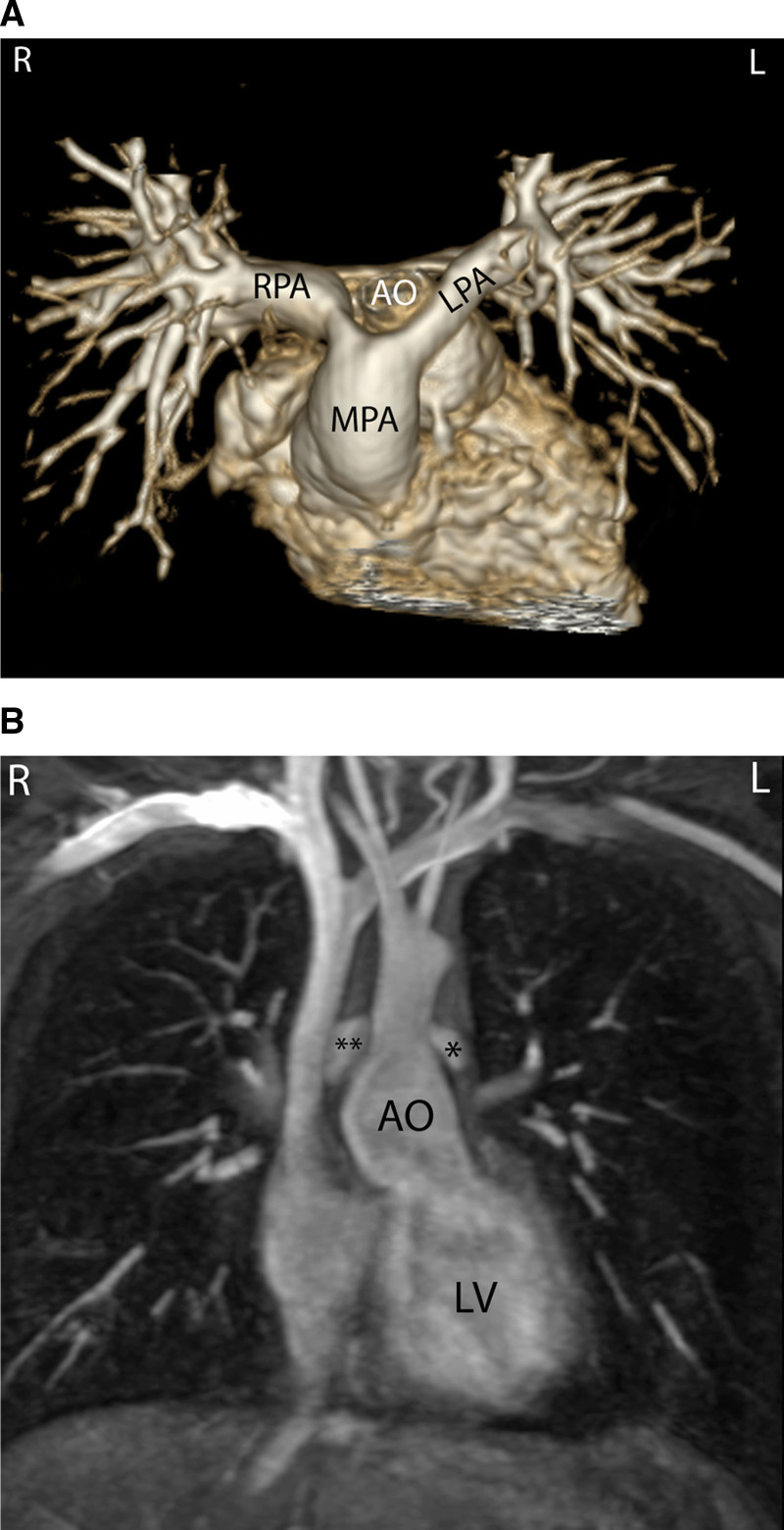 Figure 12.