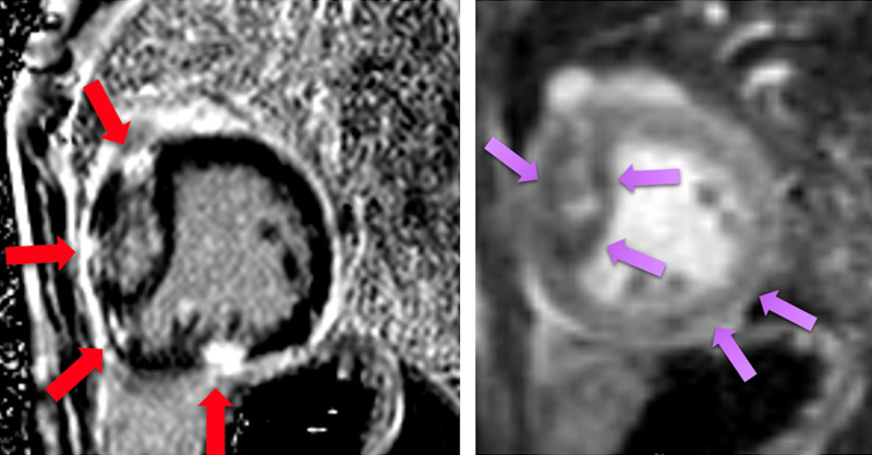 Figure 23.