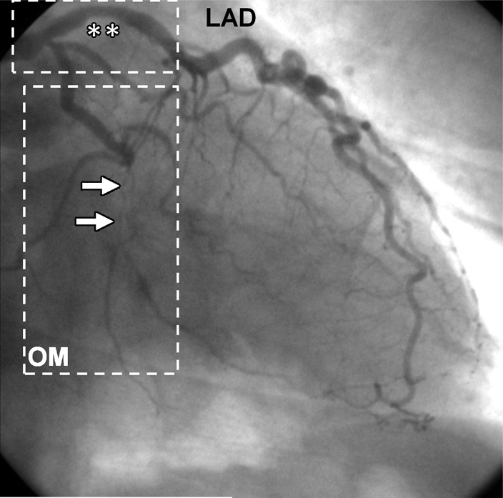 Figure 2b: