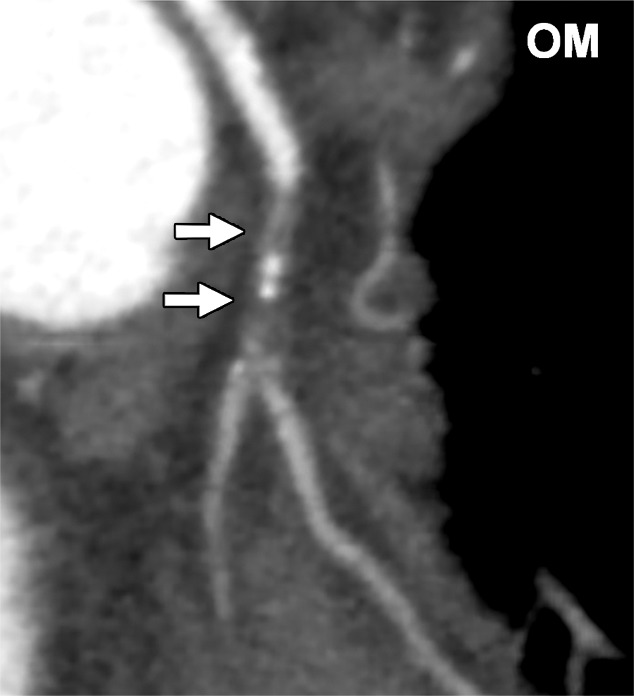 Figure 2a: