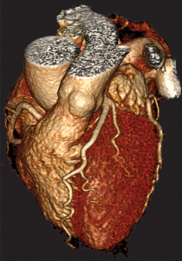 Figure 3a: