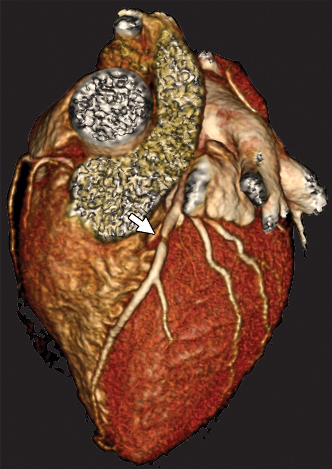 Figure 1c: