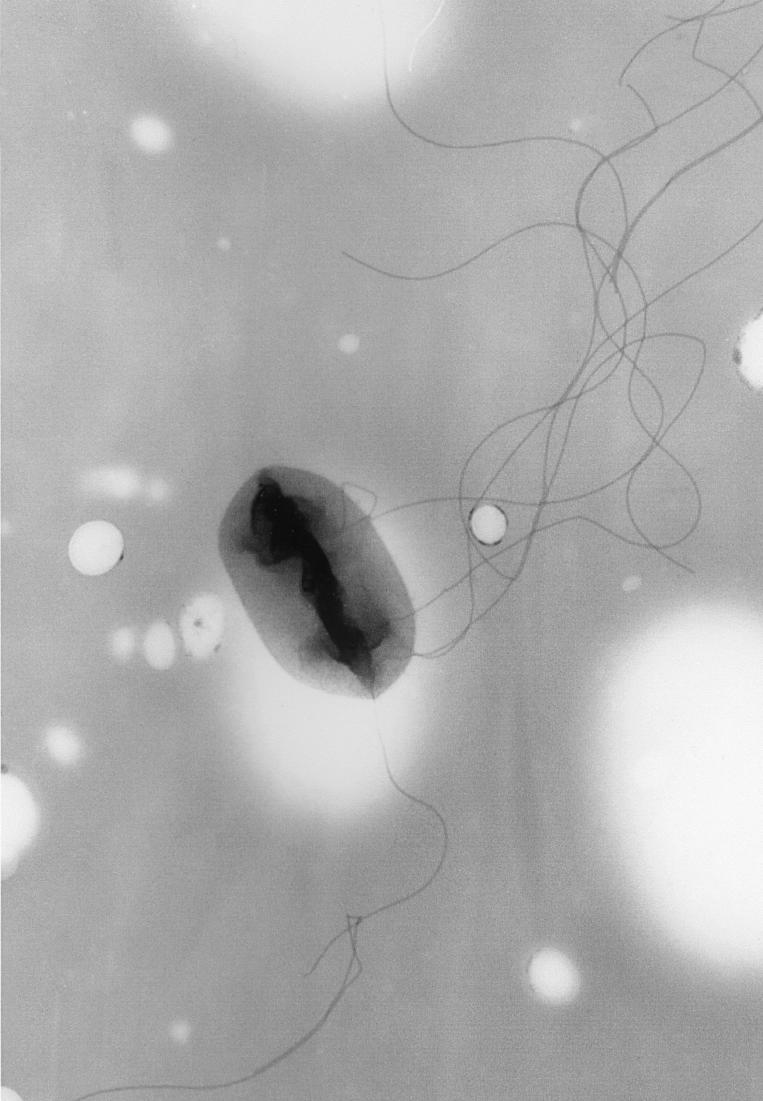 
Escherichia coli (visualized with transmission electron microscopy, above) was used as a model system to predict the regulatory DNA targets of sigma factors, bacterial proteins induced by stress. Image: CDC/Elizabeth H. White, M.S