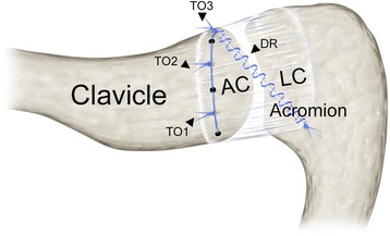 Fig. 11