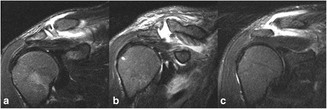 Fig. 12