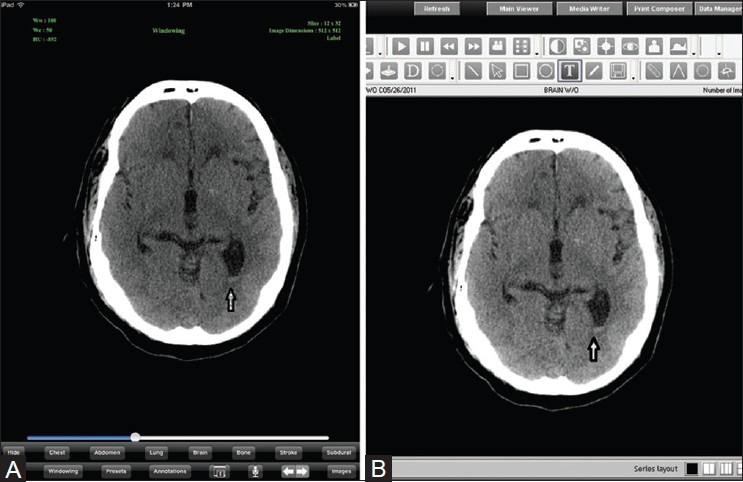 Figure 3 (A, B)