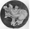 542-1