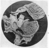 542-1