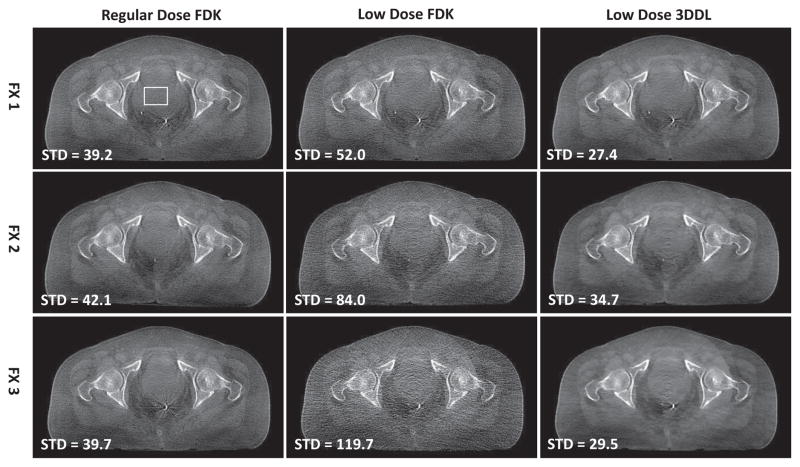 Fig. 12