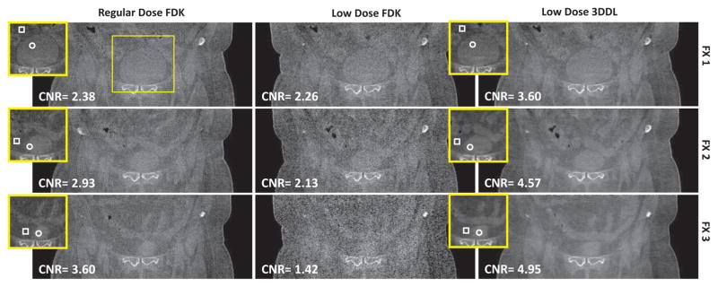 Fig. 13