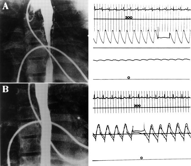 Figure 2  