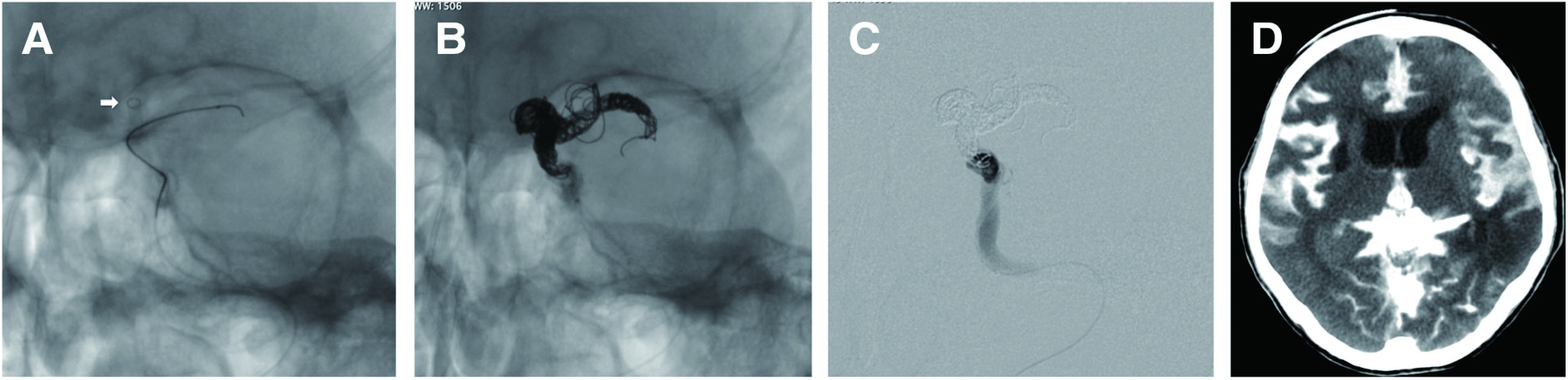 Fig. 4 