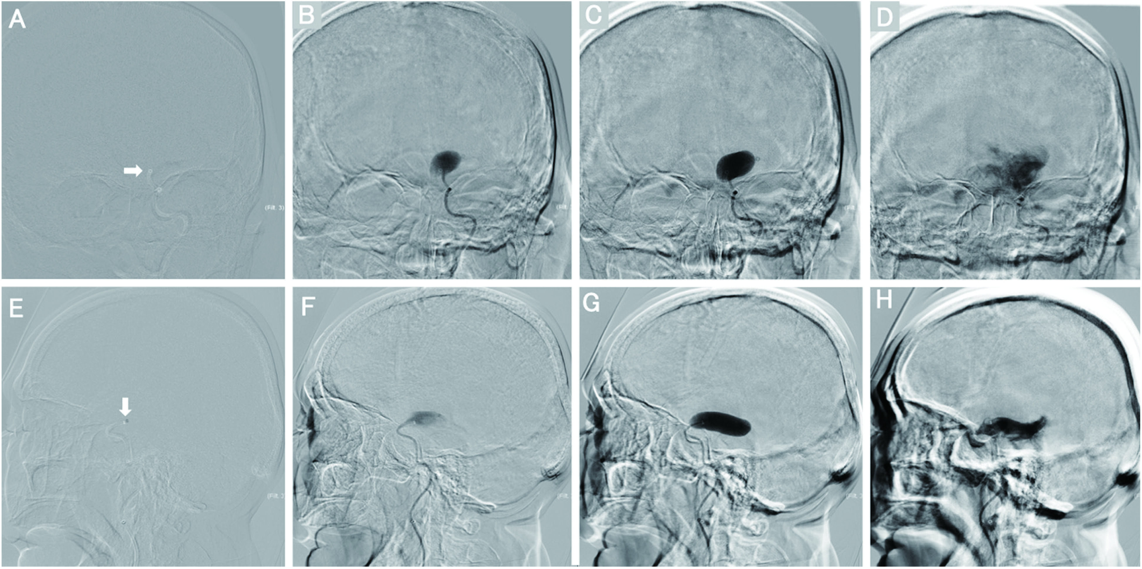 Fig. 3 