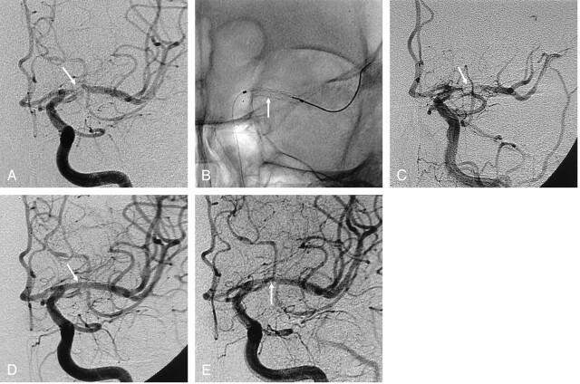 Fig 2.