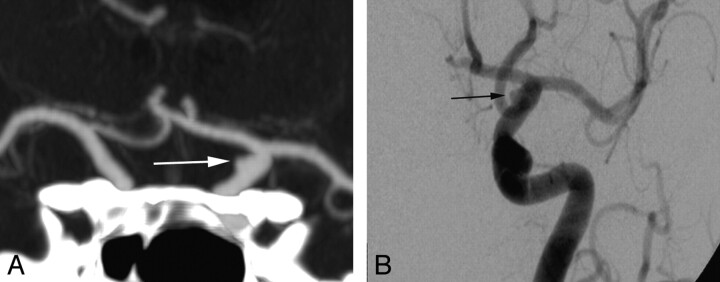 Fig 2.