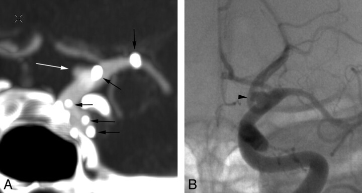 Fig 3.