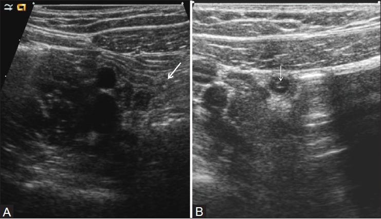 Figure 1(A, B)