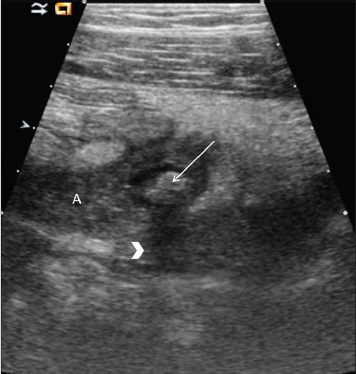 Figure 3(A, B)