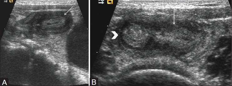 Figure 10(A, B)