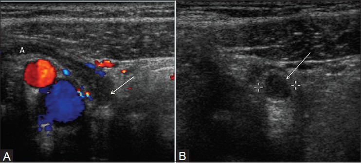 Figure 6(A, B)