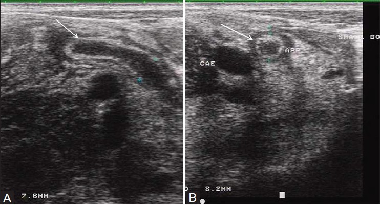 Figure 2(A, B)