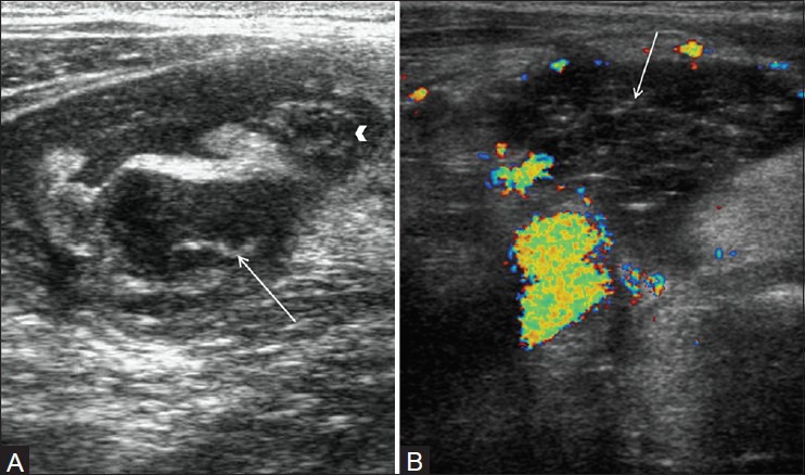 Figure 5(A, B)