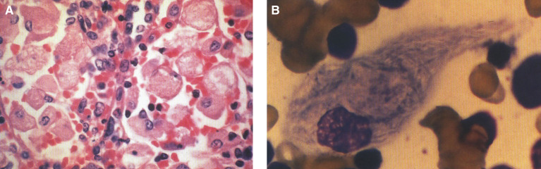 Fig.19