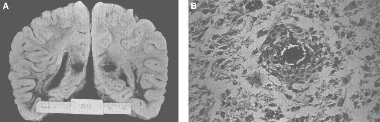 Fig.21