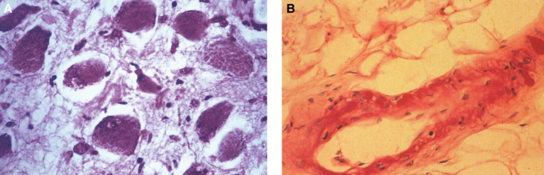 Fig.38