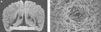 Fig.21