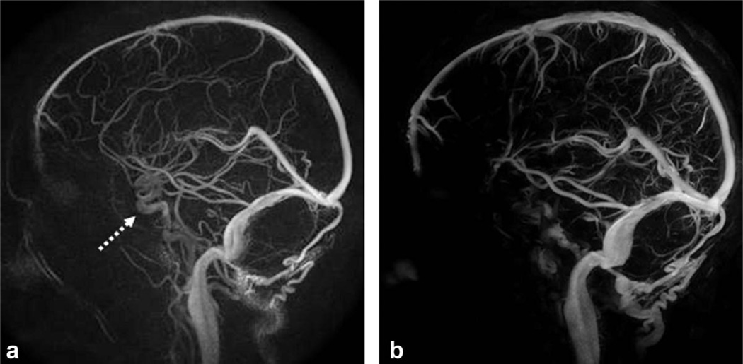 FIG. 5