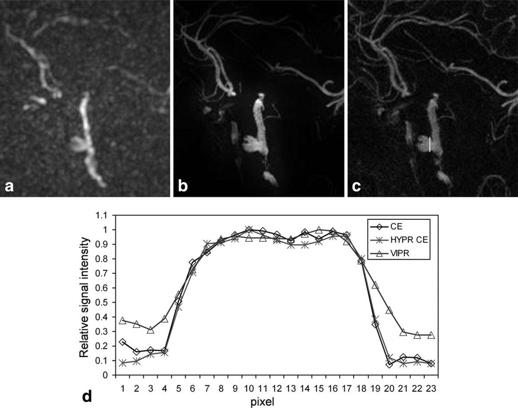 FIG. 3