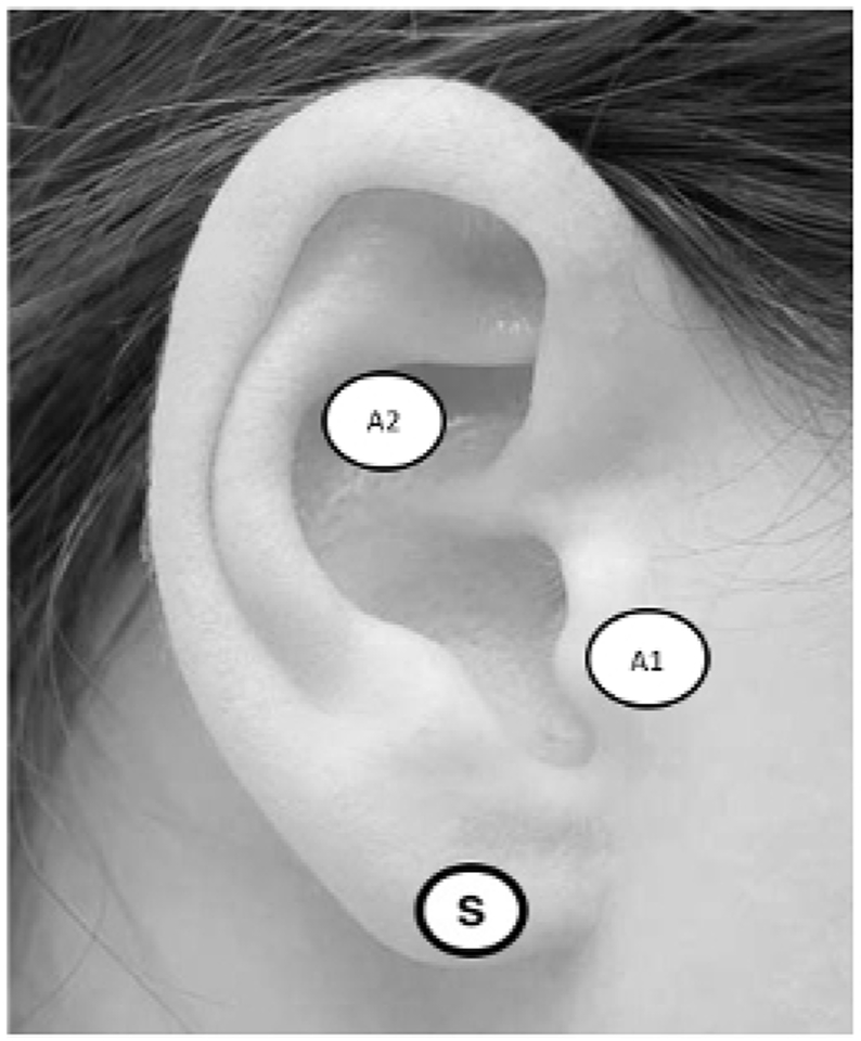 Figure 2: