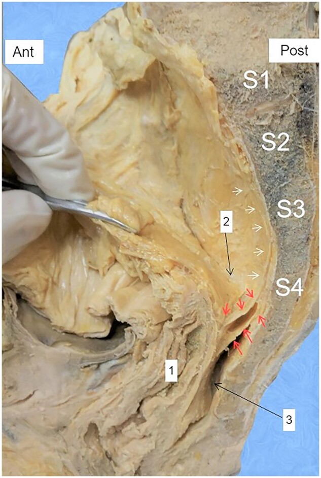 Figure 3.