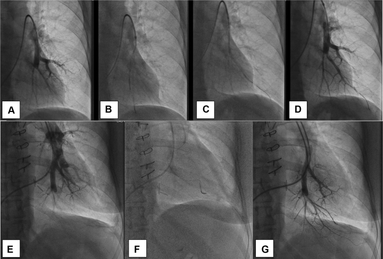 Figure 4