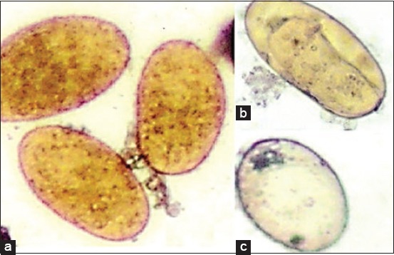 Figure-4