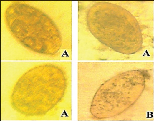 Figure-5