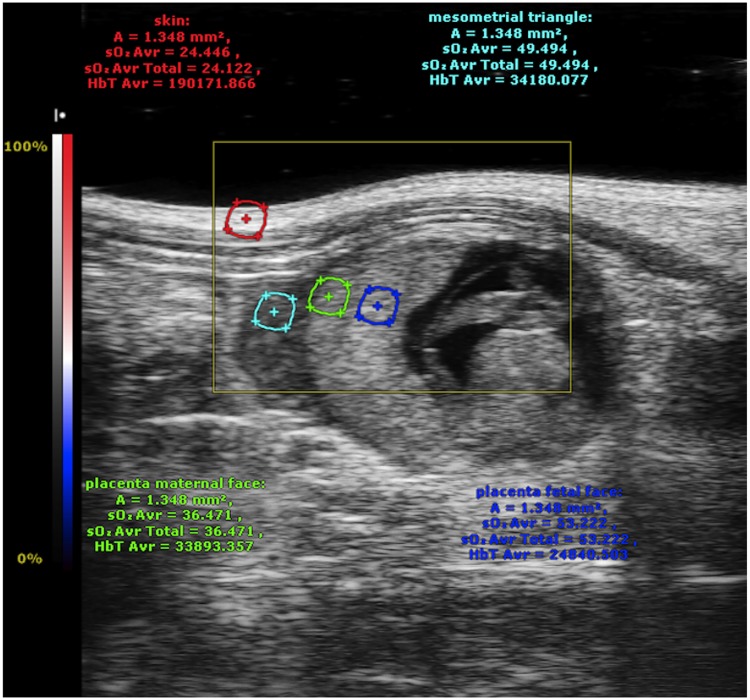 Fig 2