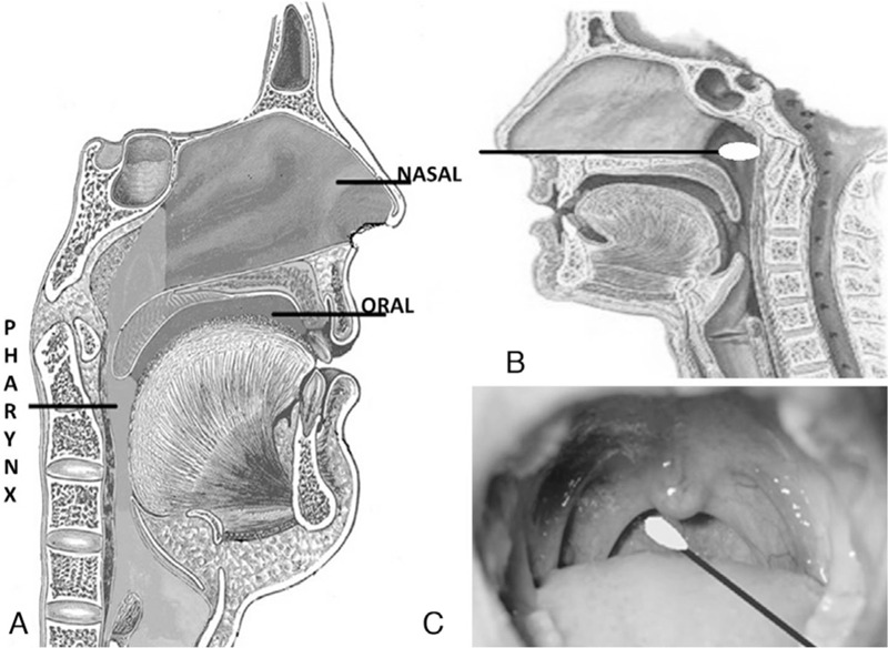 FIGURE 1