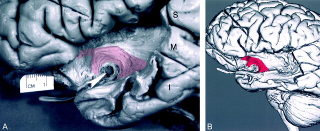 Fig 2.