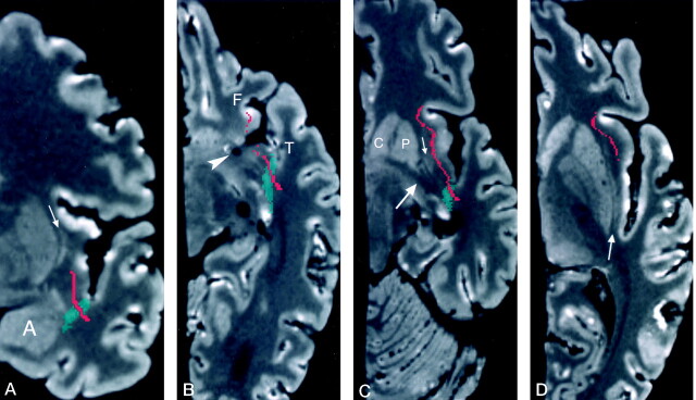 Fig 3.