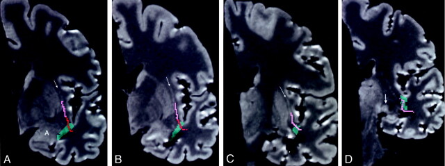 Fig 6.